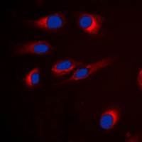 Immunofluorescent analysis of GPR18 staining in H9C2 cells. Formalin-fixed cells were permeabilized with 0.1% Triton X-100 in TBS for 5-10 minutes and blocked with 3% BSA-PBS for 30 minutes at room temperature. Cells were probed with the primary antibody in 3% BSA-PBS and incubated overnight at 4 C in a humidified chamber. Cells were washed with PBST and incubated with a DyLight 594-conjugated secondary antibody (red) in PBS at room temperature in the dark. DAPI was used to stain the cell nuclei (blue).