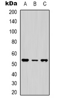 Western blot analysis of NTR1 expression in Hela (A); MCF7 (B); Jurkat (C) whole cell lysates.