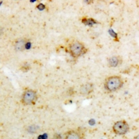 Immunohistochemical analysis of NTR1 staining in human brain formalin fixed paraffin embedded tissue section. The section was pre-treated using heat mediated antigen retrieval with sodium citrate buffer (pH 6.0). The section was then incubated with the antibody at room temperature and detected using an HRP conjugacompact polymer system. DAB was used as the chromogen. The section was then counterstained with haematoxylin and mounted with DPX.