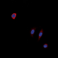 Immunofluorescent analysis of NTR1 staining in SKNSH cells. Formalin-fixed cells were permeabilized with 0.1% Triton X-100 in TBS for 5-10 minutes and blocked with 3% BSA-PBS for 30 minutes at room temperature. Cells were probed with the primary antibody in 3% BSA-PBS and incubated overnight at 4 deg C in a hidified chamber. Cells were washed with PBST and incubated with a DyLight 594-conjugated secondary antibody (red) in PBS at room temperature in the dark. DAPI was used to stain the cell nuclei (blue).