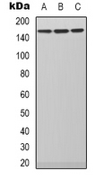 Western blot analysis of PLC beta 3 expression in SHSY5Y (A); Hela (B); NIH3T3 (C) whole cell lysates.