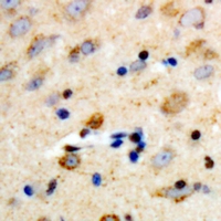 Immunohistochemical analysis of PLC beta 3 staining in human brain formalin fixed paraffin embedded tissue section. The section was pre-treated using heat mediated antigen retrieval with sodium citrate buffer (pH 6.0). The section was then incubated with the antibody at room temperature and detected using an HRP conjugacompact polymer system. DAB was used as the chromogen. The section was then counterstained with haematoxylin and mounted with DPX.