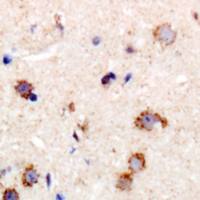 Immunohistochemical analysis of MYPT1 staining in human brain formalin fixed paraffin embedded tissue section. The section was pre-treated using heat mediated antigen retrieval with sodium citrate buffer (pH 6.0). The section was then incubated with the antibody at room temperature and detected using an HRP conjugacompact polymer system. DAB was used as the chromogen. The section was then counterstained with haematoxylin and mounted with DPX.