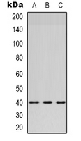 Western blot analysis of HSD3B7 expression in Lovo (A); MCF7 (B); Hela (C) whole cell lysates.