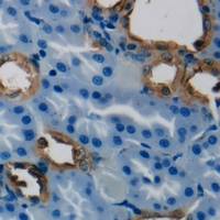 Immunohistochemical analysis of HSD3B7 staining in human kidney formalin fixed paraffin embedded tissue section. The section was pre-treated using heat mediated antigen retrieval with sodium citrate buffer (pH 6.0). The section was then incubated with the antibody at room temperature and detected using an HRP conjugacompact polymer system. DAB was used as the chromogen. The section was then counterstained with haematoxylin and mounted with DPX.