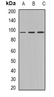 Western blot analysis of Plakophilin 2 expression in Jurkat (A); HepG2 (B); HEK293T (C) whole cell lysates.