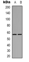 Western blot analysis of GPR101 expression in Hela (A); rat muscle (B) whole cell lysates.