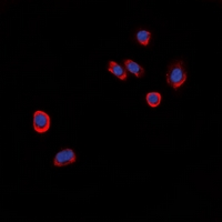 Immunofluorescent analysis of GPR101 staining in HeLa cells. Formalin-fixed cells were permeabilized with 0.1% Triton X-100 in TBS for 5-10 minutes and blocked with 3% BSA-PBS for 30 minutes at room temperature. Cells were probed with the primary antibody in 3% BSA-PBS and incubated overnight at 4 deg C in a hidified chamber. Cells were washed with PBST and incubated with a DyLight 594-conjugated secondary antibody (red) in PBS at room temperature in the dark. DAPI was used to stain the cell nuclei (blue).