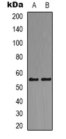 Western blot analysis of DOK2 expression in Jurkat (A); K562 (B) whole cell lysates.