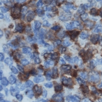 Immunohistochemical analysis of DOK2 staining in human lymph node formalin fixed paraffin embedded tissue section. The section was pre-treated using heat mediated antigen retrieval with sodium citrate buffer (pH 6.0). The section was then incubated with the antibody at room temperature and detected using an HRP conjugacompact polymer system. DAB was used as the chromogen. The section was then counterstained with haematoxylin and mounted with DPX.