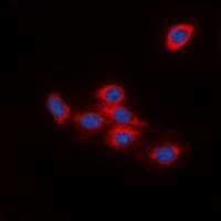 Immunofluorescent analysis of DOK2 staining in HeLa cells. Formalin-fixed cells were permeabilized with 0.1% Triton X-100 in TBS for 5-10 minutes and blocked with 3% BSA-PBS for 30 minutes at room temperature. Cells were probed with the primary antibody in 3% BSA-PBS and incubated overnight at 4 deg C in a hidified chamber. Cells were washed with PBST and incubated with a DyLight 594-conjugated secondary antibody (red) in PBS at room temperature in the dark. DAPI was used to stain the cell nuclei (blue).