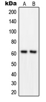 Western blot analysis of GRB14 expression in MOLT4 (A); COLO205 (B) whole cell lysates.
