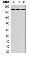 Western blot analysis of FANCD2 expression in HT29 (A); SP20 (B); mouse liver (C) whole cell lysates.