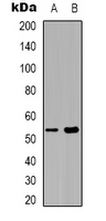 Western blot analysis of Septin 1 expression in COLO205 (A); Raw264.7 (B) whole cell lysates.