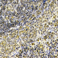 Immunohistochemical analysis of Septin 1 staining in human spleen formalin fixed paraffin embedded tissue section. The section was pre-treated using heat mediated antigen retrieval with sodium citrate buffer (pH 6.0). The section was then incubated with the antibody at room temperature and detected using an HRP conjugacompact polymer system. DAB was used as the chromogen. The section was then counterstained with haematoxylin and mounted with DPX.