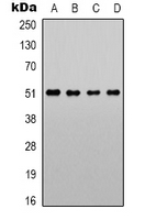 Western blot analysis of Alpha-1A Adrenergic Receptor expression in LOVO (A); Jurkat (B); NIH3T3 (C); PC12 (D) whole cell lysates.