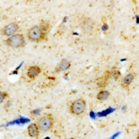 Immunohistochemical analysis of Alpha-1A Adrenergic Receptor staining in human brain formalin fixed paraffin embedded tissue section. The section was pre-treated using heat mediated antigen retrieval with sodium citrate buffer (pH 6.0). The section was then incubated with the antibody at room temperature and detected using an HRP conjugacompact polymer system. DAB was used as the chromogen. The section was then counterstained with haematoxylin and mounted with DPX.