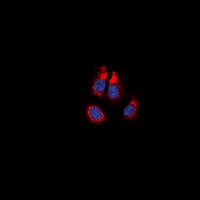 Immunofluorescent analysis of Alpha-1A Adrenergic Receptor staining in NIH3T3 cells. Formalin-fixed cells were permeabilized with 0.1% Triton X-100 in TBS for 5-10 minutes and blocked with 3% BSA-PBS for 30 minutes at room temperature. Cells were probed with the primary antibody in 3% BSA-PBS and incubated overnight at 4 deg C in a hidified chamber. Cells were washed with PBST and incubated with a DyLight 594-conjugated secondary antibody (red) in PBS at room temperature in the dark. DAPI was used to stain the cell nuclei (blue).