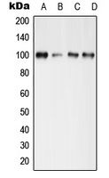 Western blot analysis of GLUR4 (pS862) expression in MCF7 Forskonlin-treated (A); mouse brain (B); mouse spleen (C); rat spleen (D) whole cell lysates.