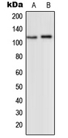 Western blot analysis of mGLUR2 expression in HEK293T (A); SHSY5Y (B) whole cell lysates.