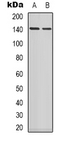 Western blot analysis of MYPT1 expression in Jurkat (A); SHSY5Y (B); COLO205 (C) whole cell lysates.