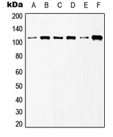 Western blot analysis of mGLUR6 expression in HeLa (A); NIH3T3 (B); Raw264.7 (C); H9C2 (D); mouse brain (E); Jurkat (F) whole cell lysates.