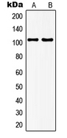 Western blot analysis of mGLUR7 expression in EOC20 (A); rat brain (B) whole cell lysates.