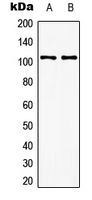 Western blot analysis of mGLUR8 expression in EOC20 (A); rat brain (B) whole cell lysates.