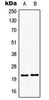 Western blot analysis of GSC2 expression in HepG2 (A); Jurkat (B) whole cell lysates.