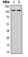 Western blot analysis of DNA Ligase 4 expression in KB (A); MCF7 (B) whole cell lysates.