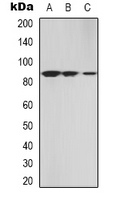 Western blot analysis of cGK 2 expression in A549 (A); NIH3T3 (B); HEK293T (C) whole cell lysates.