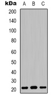 Western blot analysis of Claudin 3 expression in Hela (A); HEK293T (B); NIH3T3 (C) whole cell lysates.