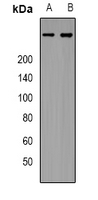 Western blot analysis of IP3R expression in Hela (A); HEK293T (B) whole cell lysates.