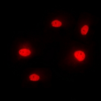 Immunofluorescent analysis of hnRNP M staining in MCF7 cells. Formalin-fixed cells were permeabilized with 0.1% Triton X-100 in TBS for 5-10 minutes and blocked with 3% BSA-PBS for 30 minutes at room temperature. Cells were probed with the primary antibody in 3% BSA-PBS and incubated overnight at 4 deg C in a hidified chamber. Cells were washed with PBST and incubated with a DyLight 594-conjugated secondary antibody (red) in PBS at room temperature in the dark. DAPI was used to stain the cell nuclei (blue).