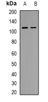 Western blot analysis of GTF3C2 expression in HuvEc (A); Hela (B) whole cell lysates.