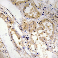 Immunohistochemical analysis of SPZ1 staining in human kidney formalin fixed paraffin embedded tissue section. The section was pre-treated using heat mediated antigen retrieval with sodium citrate buffer (pH 6.0). The section was then incubated with the antibody at room temperature and detected using an HRP conjugacompact polymer system. DAB was used as the chromogen. The section was then counterstained with haematoxylin and mounted with DPX.
