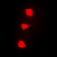 Immunofluorescent analysis of SPZ1 staining in A549 cells. Formalin-fixed cells were permeabilized with 0.1% Triton X-100 in TBS for 5-10 minutes and blocked with 3% BSA-PBS for 30 minutes at room temperature. Cells were probed with the primary antibody in 3% BSA-PBS and incubated overnight at 4 deg C in a hidified chamber. Cells were washed with PBST and incubated with a DyLight 594-conjugated secondary antibody (red) in PBS at room temperature in the dark. DAPI was used to stain the cell nuclei (blue).