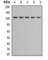 Western blot analysis of DNA Ligase 3 expression in Jurkat (A); NIH3T3 (B); MCF7 (C); PC3 (D); Hela (E) whole cell lysates.