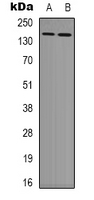 Western blot analysis of TAB182 expression in HEK293T (A); NIH3T3 (B) whole cell lysates.