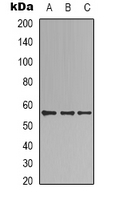 Western blot analysis of B3GALTL expression in HEK293T (A); MCF7 (B); HepG2 (C) whole cell lysates.