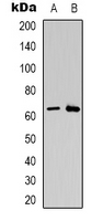 Western blot analysis of CSGALNACT2 expression in K562 (A); Jurkat (B) whole cell lysates.