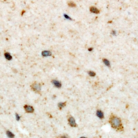 Immunohistochemical analysis of CSGALNACT2 staining in human brain formalin fixed paraffin embedded tissue section. The section was pre-treated using heat mediated antigen retrieval with sodium citrate buffer (pH 6.0). The section was then incubated with the antibody at room temperature and detected using an HRP conjugacompact polymer system. DAB was used as the chromogen. The section was then counterstained with haematoxylin and mounted with DPX.