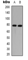 Western blot analysis of DNAI1 expression in K562 (A); mouse brain (B) whole cell lysates.