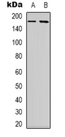Western blot analysis of NBEAL1 expression in HEK293T (A); HepG2 (B) whole cell lysates.