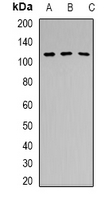 Western blot analysis of PRPF6 expression in Hela (A); HEK293T (B); mouse brain (C) whole cell lysates.