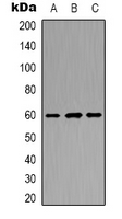 Western blot analysis of POTEB expression in Jurkat (A); mouse kidney (B); NIH3T3 (C) whole cell lysates.