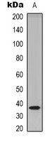 Western blot analysis of TECR expression in HEK293T (A) whole cell lysates.