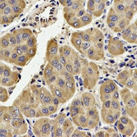 Immunohistochemical analysis of TECR staining in human liver formalin fixed paraffin embedded tissue section. The section was pre-treated using heat mediated antigen retrieval with sodium citrate buffer (pH 6.0). The section was then incubated with the antibody at room temperature and detected using an HRP conjugacompact polymer system. DAB was used as the chromogen. The section was then counterstained with haematoxylin and mounted with DPX.