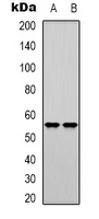Western blot analysis of DNA Polymerase mu expression in K562 (A); Jurkat (B) whole cell lysates.
