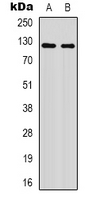 Western blot analysis of XPO1 (AcK568) expression in HepG2 UV-treated (A); mouse brain (B) whole cell lysates.
